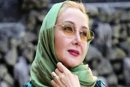 کتایون ریاحی به سیم آخر زد | عمل زیبایی از “کتایون ریاحی” فرشته ساخت + عکس