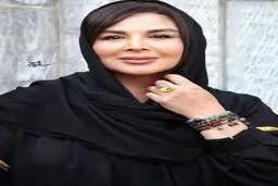 کسی باورش نمیشه این خانم همون شهره سلطانیه! | تصویر جدید شهره سلطانی بعد از عمل زیبایی +تصویر