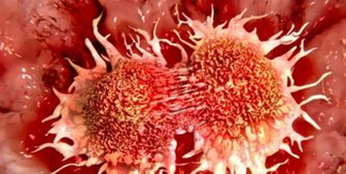 سرکوب طبیعی تومور‌های سرطانی با نانو ذرات