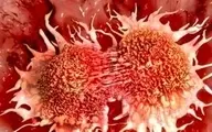 سرکوب طبیعی تومور‌های سرطانی با نانو ذرات