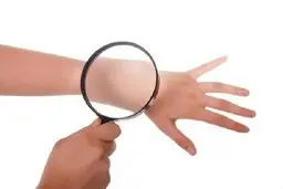 کراتوز آکتینیک چیست؟ + درمان 