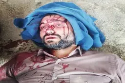 حمله مسلحانه به شهردار ناحیه ۳ منطقه ۱۹+تصویر