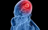 علائم و نشانه‌های هشداردهنده تومور مغزی