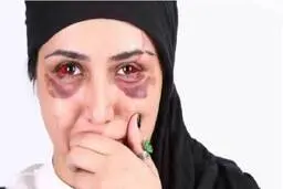 بازیگرانی که از مرگ جان سالم به در بردند + جزئیات