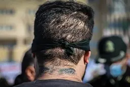 حمله اوباش خیابانی به پلیس با اسید