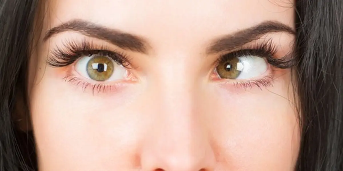 5 ورزش چشم برای درمان انحراف چشم