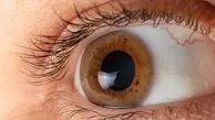 
ژنی که کلید درمان یک بیماری نادر چشمی است
