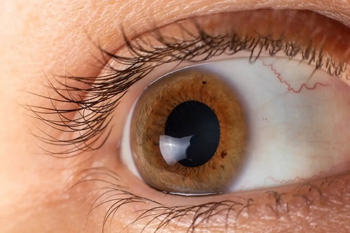داروهایی که در خشکی چشم موثرند + درمان 