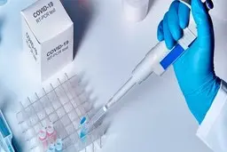 
نتایج اولیه تست‌های پلاسمای کرونا مثبت اعلام شد
