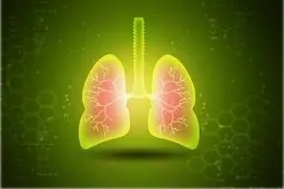 ارتباط عنصر کادمیوم با بروز عفونت شدید آنفلوانزا و ذات الریه