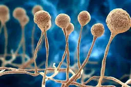 ۲۰ بیمار مبتلا به قارچ سیاه در مشهد مشاهده شد