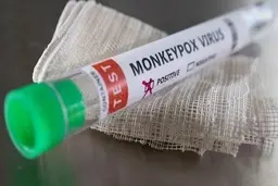 آبله میمونی بلای جان ایرانی ها ؟| نگرانی ها بالا گرفت | درخواست وزارت بهداشت برای واکسن آبله میمونی