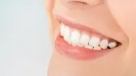 چگونه می‌توان از دندان‌ها ویژگی شخصی افراد را تشخیص داد ؟ +تصویر