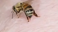 فواید و مضرات نیش زنبور عسل که از آن بی‌خبرید