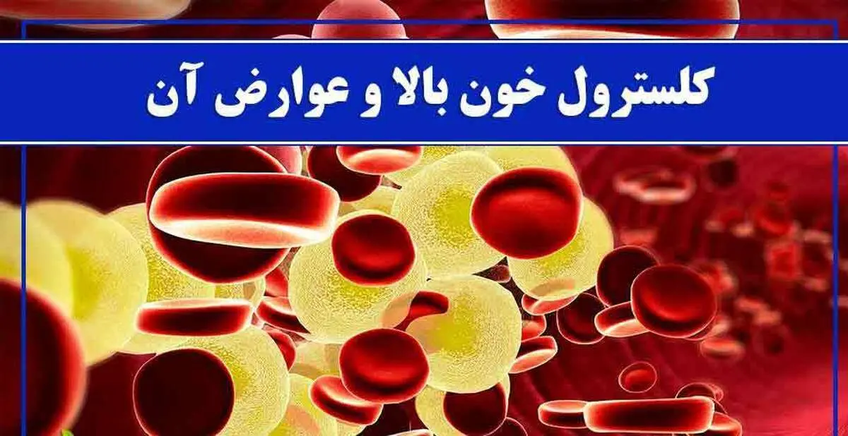  عوارض کلسترول بالا در سن جوانی