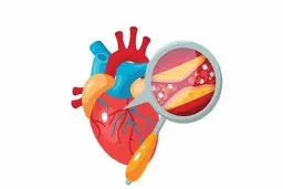 علائم اولیه گرفتگی رگ‌ های قلب چیست؟ | این علائم را جدی بگیرید!