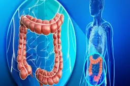 بیماری‌های  ناشی از استرس |  علائم بیماری التهابی روده