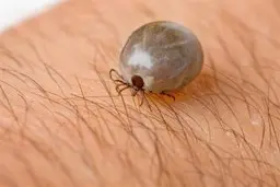 در تربت جام  ۱۶ بیمار مشکوک به تب کریمه کنگو شناسایی شدند