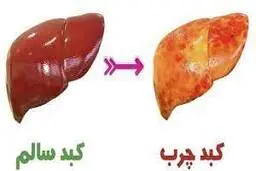 با این روش ساده کبد چرب را درمان کنید | درمان کبد چرب