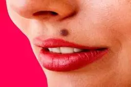 شخصیت شناسی خال صورت و بدن |  رازهایی که خال هایتان در مورد شما میگوید