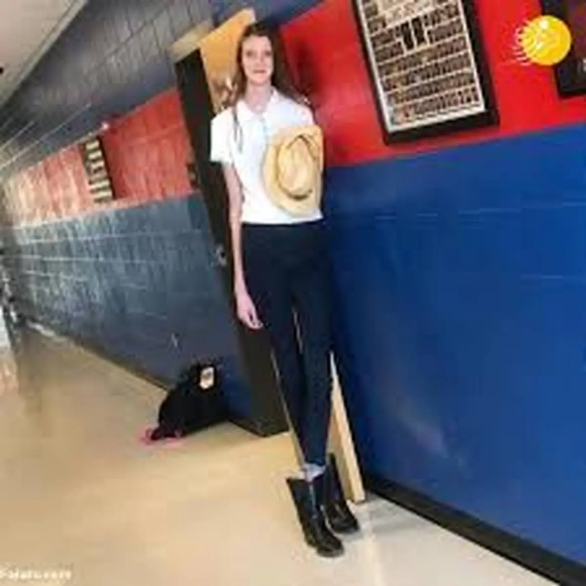 دختر نوجوانی که  بلندترین پاهای جهان را دارد+عکس