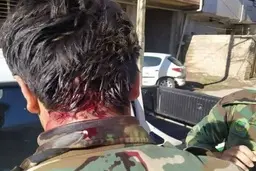 زخمی شدن جنگلبان با سلاح سرد در درگیری با یک دامدار متخلف