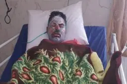  بلوط ‌های زاگرس  برای تو می‌گریند «البرز»!