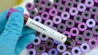 کروناویروس از منظر یک ویروس شناس