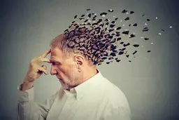 بیش از ۵۵ میلیون انسان در جهان با زوال عقل زندگی می‌کنند