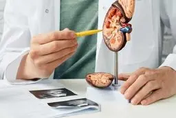 این ماده را هر روز بخورید تا سنگ کلیه نگیرید | سنگ کلیه چیست؟