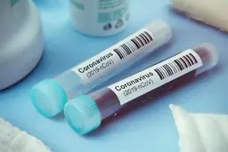 
پایگاه مدیکال اکسپرس: داروی آزمایشی جدید، بیماری Covid-۱۹ را در مراحل اولیه نابود می‌کند
