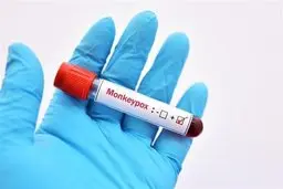 پاسخ به ۱۴ سوال مهم درباره آبله میمون | همه چیز درباره آبله میمون 