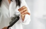 درمان ریزش مو پس ازابتلا به کرونا