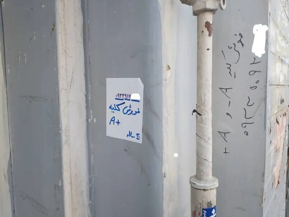 فروش کلیه در ازای خرید پراید برای مسافرکشی!