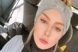 چهره باورنکردنی سحر قریشی پس از جدایی از تتلو | تتو صورت سحر را نابود کرد + عکس