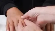 انگشت مصنوعی ای که کارایی یک انگشت واقعی را دارد! + ویدئو