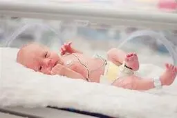 نوزادی که از مرگ حتمی نجات یافت! | جنگ بین مرگ و زندگی برای نوزادی با وزن کمتر از نیم کیلو! + ویدئو