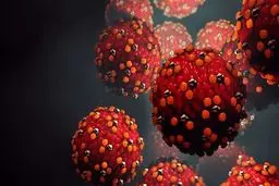 افزایش موارد سرخک در کشور دیده شده