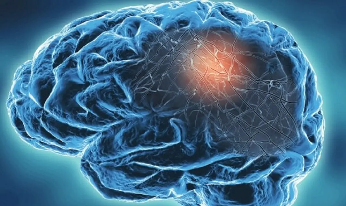  ابتلای شدید به کرونا مغز را ۲۰ سال پیر می‌کند