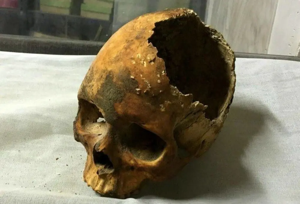 تلاش برای درمان سرطان در ۴۰۰۰ سال قبل در مصر |  جمجمه جراحی شده توسط مصریان همه را متعجب کرد  +تصویر