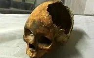 تلاش برای درمان سرطان در ۴۰۰۰ سال قبل در مصر |  جمجمه جراحی شده توسط مصریان همه را متعجب کرد  +تصویر