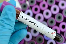 کرونایی های استقلال کم شدند | کرونایی‌های استقلال به چند نفر رسیدند؟