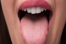تشخیص بیماری‌ها از روی زبان | از روی زبان می‌توان به وجود بیماری پی برد؟