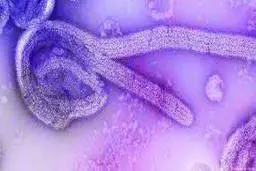 ویروس جدید به جان دنیا افتاد | شیوع ویروس ماربورگ در گینه استوایی | 9 کشته تا کنون!