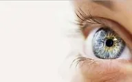 چشم ها در مورد سلامتی ما چه می گویند؟