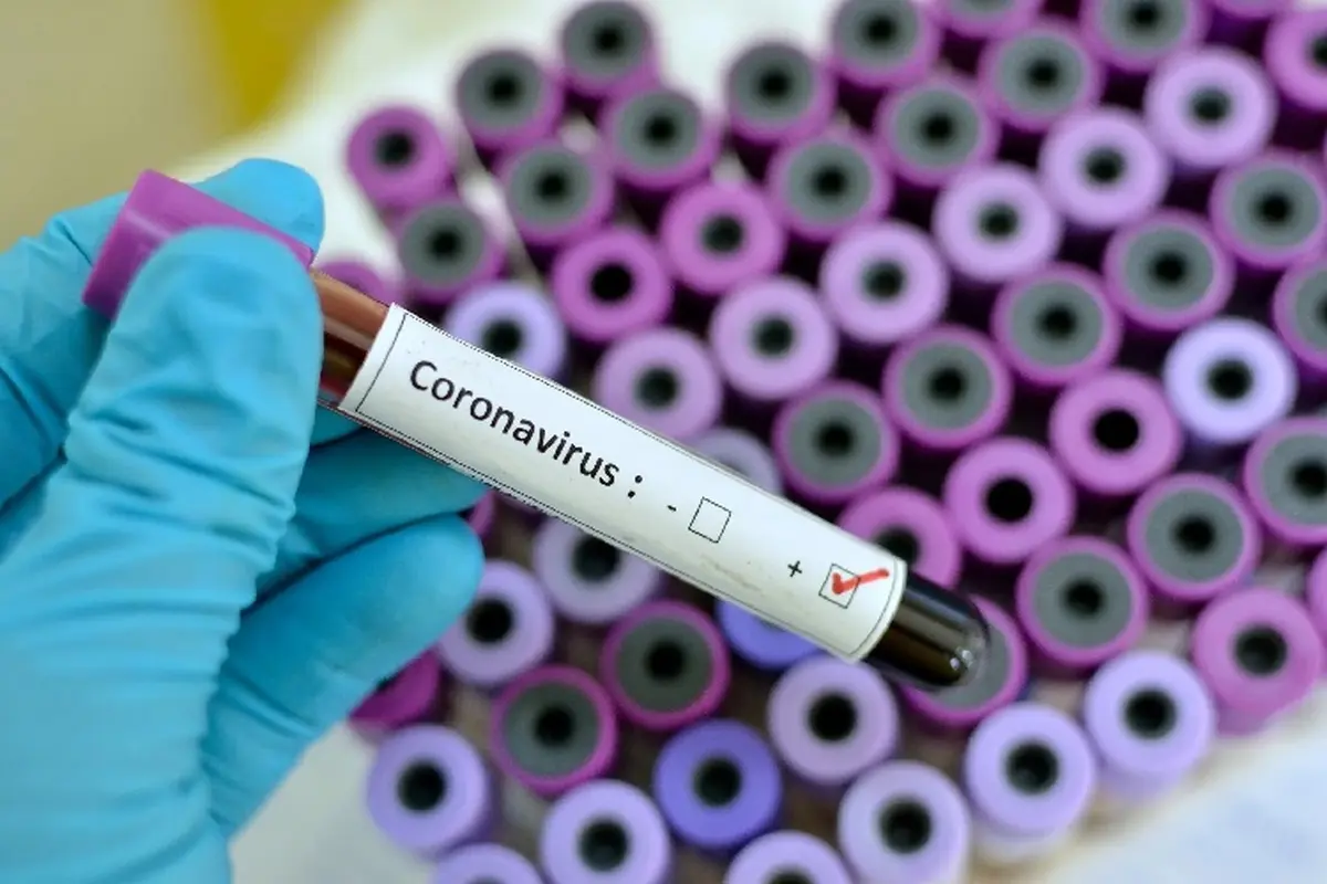فرق ویروس کرونا با آنفلوانزا، سینوزیت، سرماخوردگی و برونشیت حاد چیست؟