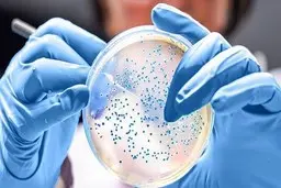 علت همه‌گیری عفونت میکروبی در روستای چنار همدان | صدها نفر مسموم شدند