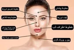 رکورد درآمد میلیاردی از بوتاکس زد روی دست جراحی قلب!