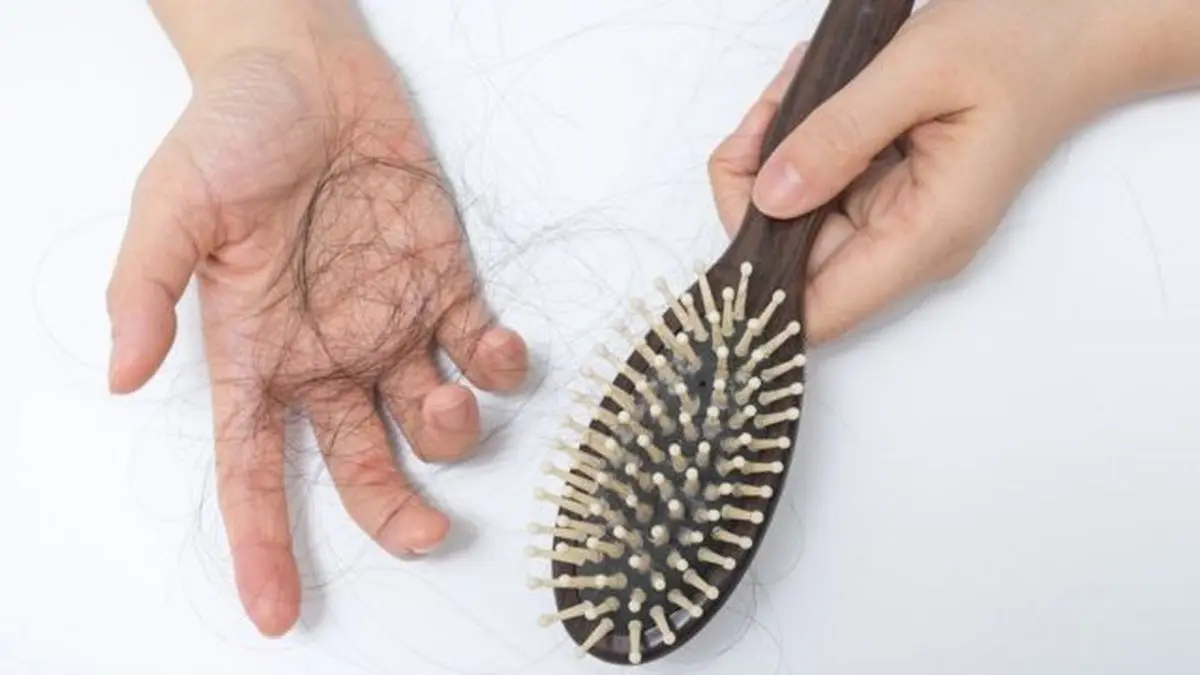 بیماری کرونا باعث ریزش موی  دائمی می شود؟
