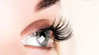 عوامل ایجاد ورم دور چشم +درمان 